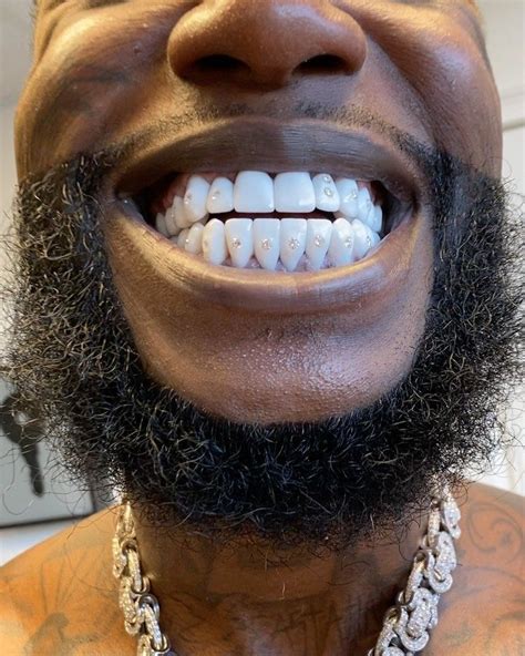 does gucci mane have fake teeth|Gucci Mane Drops $250K Bands On New Diamond Teeth.